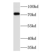 WB analysis of mouse lung tissue, using TCF12 antibody (1/300 dilution).