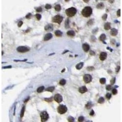 Transcription Factor 4 (TCF4) Antibody