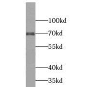 WB analysis of mouse lung tissue, using TCF4 antibody (1/600 dilution).