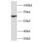 WB analysis of mouse brain tissue, using TCF7L1 antibody (1/1000 dilution).