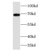 WB analysis of mouse liver tissue, using TCF7L2 antibody (1/1000 dilution).