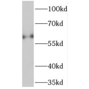 WB analysis of MCF-7 cells, using TCHP antibody (1/600 dilution).