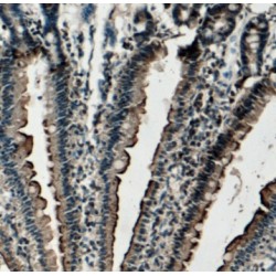 Transcobalamin-2 (TCN2) Antibody