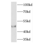 WB analysis of A375 cells, using TCN2 antibody (1/100 dilution).