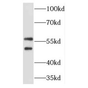 WB analysis of human testis tissue, using TCP11 antibody (1/3000 dilution).