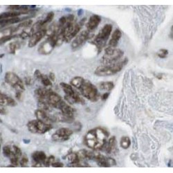 TAR DNA-Binding Protein 43 (TDP-43) Antibody