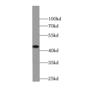 WB analysis of A549 cells (shControl and shRNA of TDP43), using TARDBP antibody (1/1000. dilution).