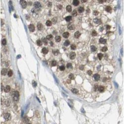 Tudor Domain Containing 5 (TDRD5) Antibody