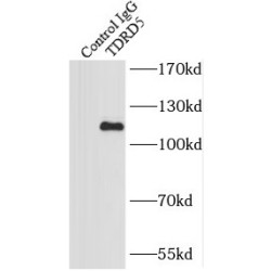 Tudor Domain Containing 5 (TDRD5) Antibody