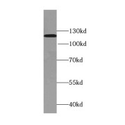 WB analysis of mouse testis tissue, using TDRD5 antibody (1/300 dilution).