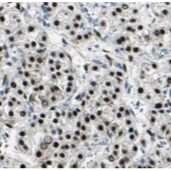 Transcriptional Enhancer Factor TEF-1 (TEAD1) Antibody