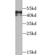 WB analysis of mouse brain tissue, using TEAD1 antibody (1/1000 dilution).