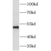 WB analysis of HEK-293 cells, using TEKT4 antibody (1/500 dilution).