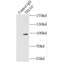 Telomere Maintenance 2 (TELO2) Antibody