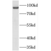 WB analysis of Y79 cells, using TELO2 antibody (1/1500 dilution).