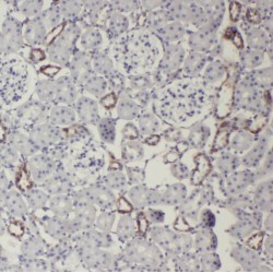 Endosialin (CD248) Antibody