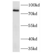 WB analysis of A375 cells, using CD248 antibody (1/200 dilution).