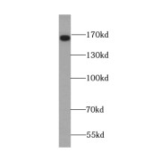 WB analysis of human brain tissue, using TNR-Specific antibody (1/300 dilution).