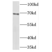 WB analysis of Jurkat cells, using TERF2 antibody (1/1000 dilution).