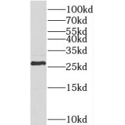 WB analysis of HeLa cells, using TESC antibody (1/300 dilution).