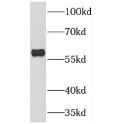 WB analysis of A431 cells, using TESPA1 antibody (1/1000 dilution).