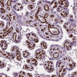 Methylcytosine Dioxygenase TET2 (TET2) Antibody
