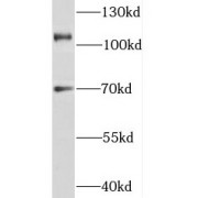 WB analysis of mouse testis tissue, using TEX11 antibody (1/500 dilution).