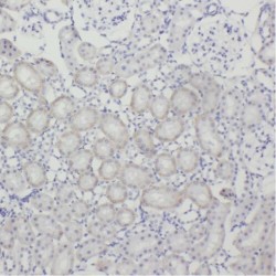 Testis Expressed 12 (TEX12) Antibody