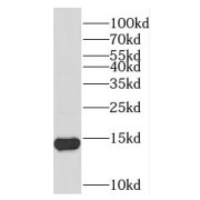 WB analysis of mouse testis tissue, using TEX12 antibody (1/400 dilution).