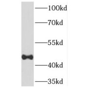 WB analysis of HL-60 cells, using TEX13A antibody (1/500 dilution).