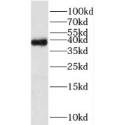 WB analysis of human brain tissue, using TFAP4 antibody (1/500 dilution).