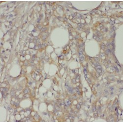 Transcription Factor EC (TFEC) Antibody