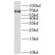 WB analysis of mouse testis tissue, using TFEC antibody (1/300 dilution).