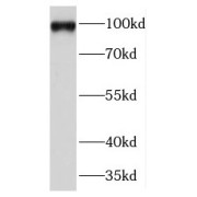 WB analysis of HeLa cells, using TFIP11 antibody (1/500 dilution).