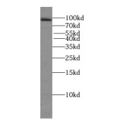 WB analysis of HeLa cells, using TFIP11 antibody (1/1000 dilution).