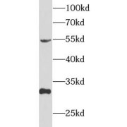 WB analysis of 293T cells cells, using TFPI antibody (1/1000 dilution).