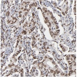 dTDP-D-Glucose 4,6-Dehydratase (TGDS) Antibody