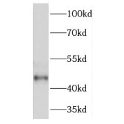 WB analysis of human kidney tissue, using TGDS antibody (1/300 dilution).