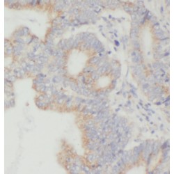 TGFBI / BIGH3 Antibody