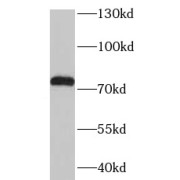 WB analysis of BxPC3 cells, using TGFBI antibody (1/600 dilution).