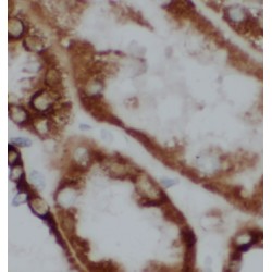 TGFBI / BIGH3 Antibody