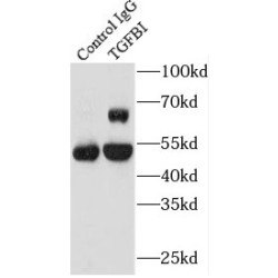 TGFBI / BIGH3 Antibody