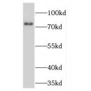 WB analysis of SGC-7901 cells, using TGM2 antibody (1/2000 dilution).