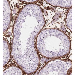 Transglutaminase 4, Prostate (TGM4) Antibody