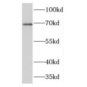 WB analysis of human testis tissue, using TGM4 antibody (1/300 dilution).