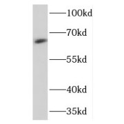 WB analysis of mouse brain tissue, using THEM4 antibody (1/500).