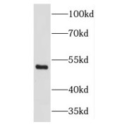 WB analysis of Jurkat cells, using THAP11 antibody (1/1000 dilution).