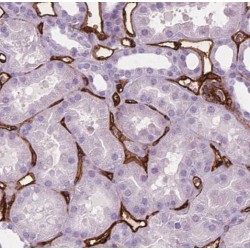 Acyl-Coenzyme A Thioesterase 13 (ACOT13) Antibody