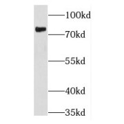 WB analysis of HEK-293 cells, using THOC5 antibody (1/600 dilution).