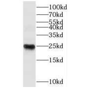 WB analysis of mouse testis tissue, using THOC7 antibody (1/800 dilution).